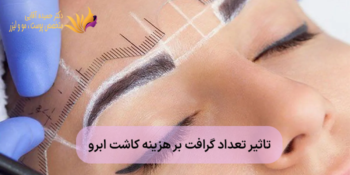 تاثیر تعداد گرافت بر هزینه کاشت ابرو