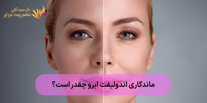 ماندگاری اندولیفت ابرو چقدر است؟