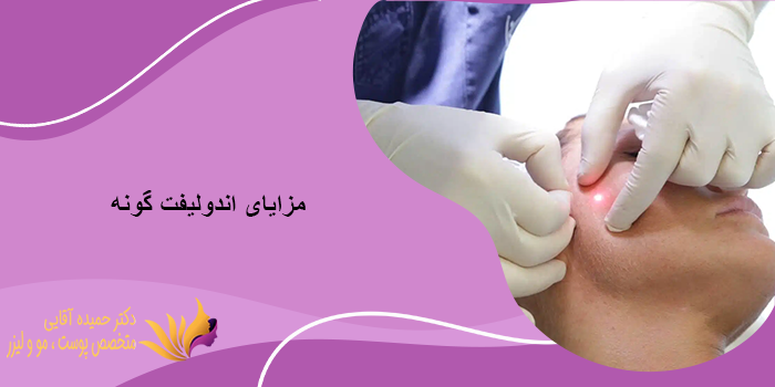 اندولیفت گونه چیست؟