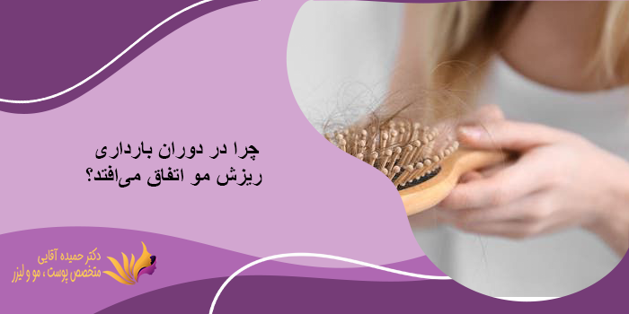 کاشت مو در بارداری