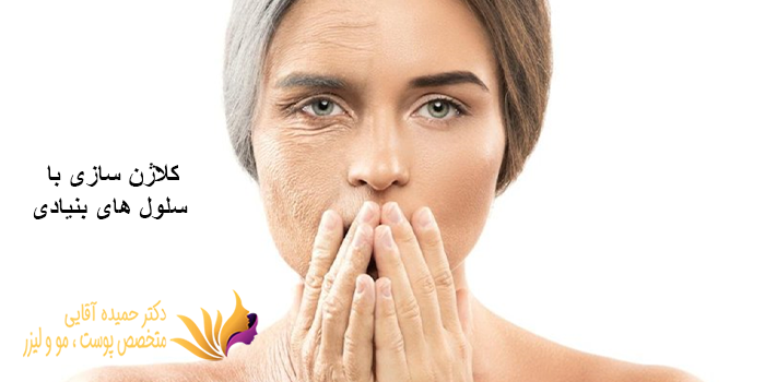 تاثیر سلولهای بنیادی در تحریک کلاژن سازی پوست