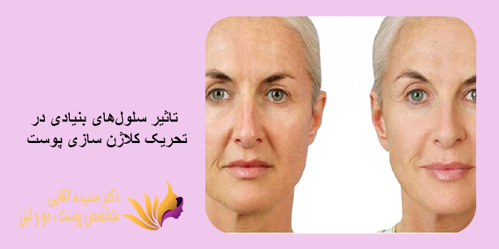 مقایسه کلاژن سازی با سلولهای بنیادی و روشهای دیگر جوانسازی