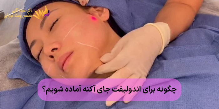 چگونه برای اندولیفت جای آکنه آماده شویم؟