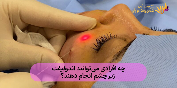 چه افرادی میتوانند اندولیفت زیر چشم انجام دهند؟