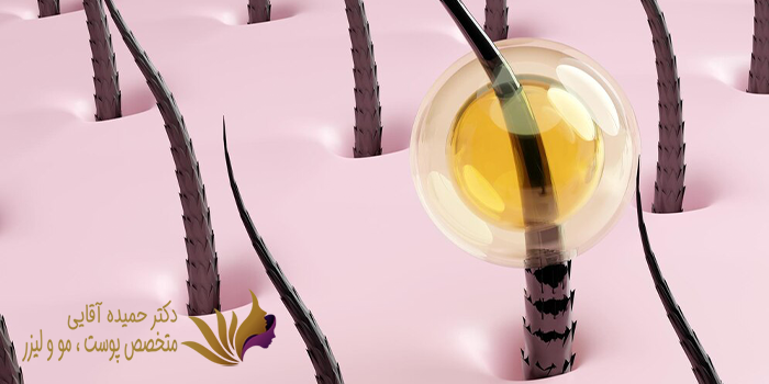 روشهای درمان ریزش مو با سلول های بنیادی چیست؟