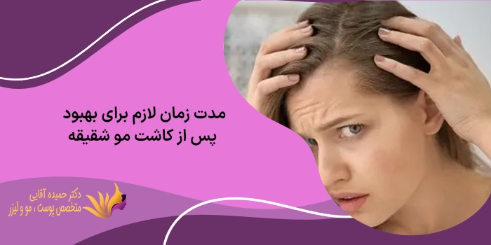 مراقبت های بعد از کاشت مو شقیقه