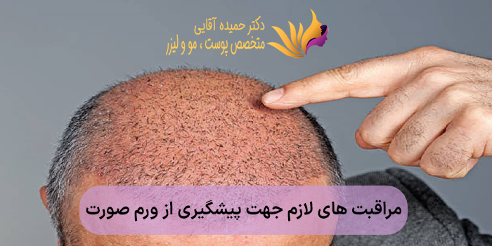 مراقبت های لازم جهت پیشگیری از ورم صورت