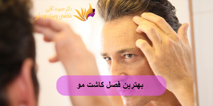 بهترین فصل کاشت مو