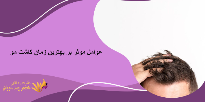 عوامل موثر بر بهترین زمان کاشت مو