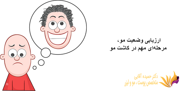 مراحل کاشت مو