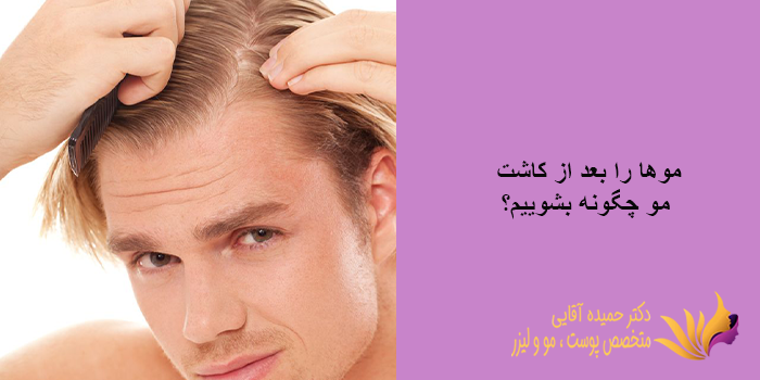 مراقبت های بعد از کاشت مو چقدر طول میکشد؟