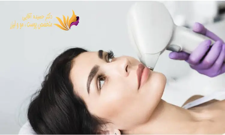 عوارض لیزر موهای زائد صورت