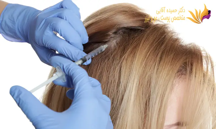 مراقبتهای بعد از تزریق سلولهای بنیادی