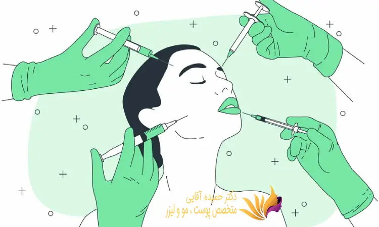 روش انجام لیزر اندولیفت چانه