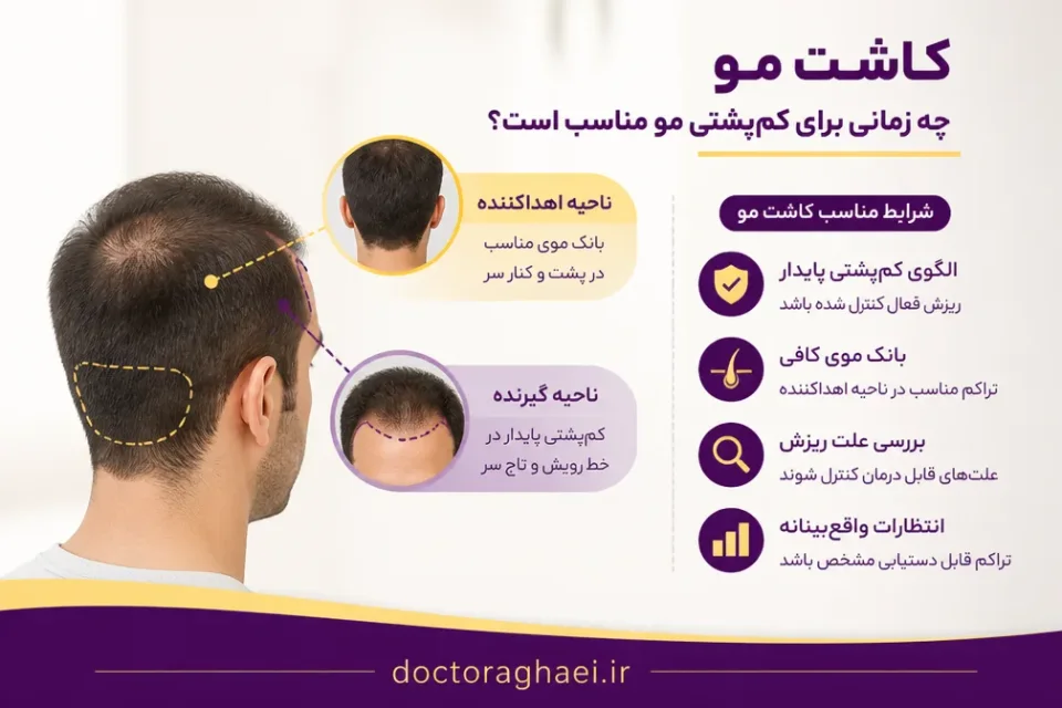 نمای توضیحی درباره کاشت مو چه زمانی برای کمپشتی مو مناسب است