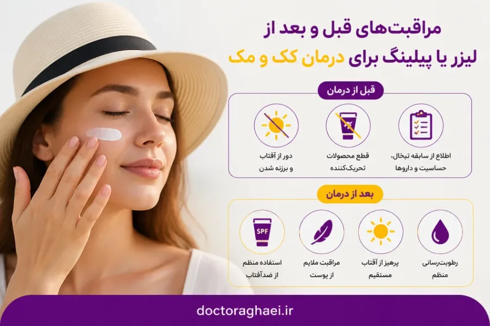 مراقبتهای قبل و بعد از لیزر یا پیلینگ — مراقبت با ضدآفتاب پس از لیزر ککومک