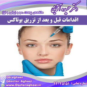 اقدامات قبل از تزریق بوتاکس چقدر اهمیت دارد؟