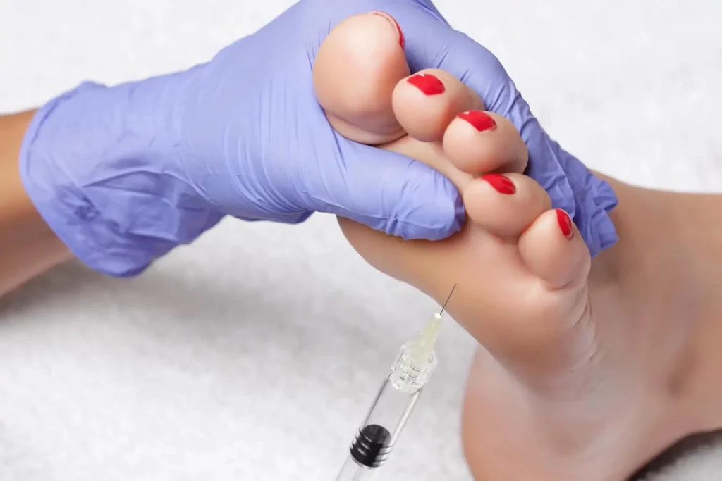 درمان تعریق کف پا با بوتاکس 