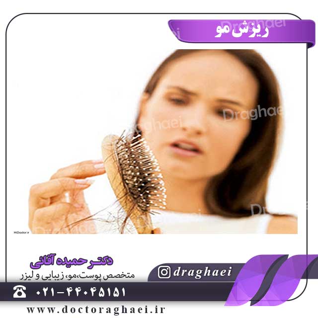 ریزش مو
