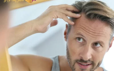 سن کاشت مو چقدر است؟ | عوامل موثر بر آن