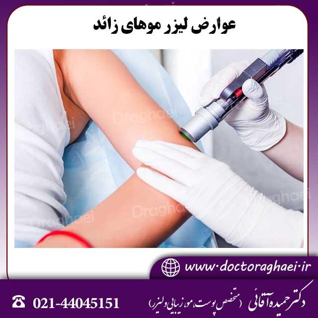 عوارض لیزر موهای زائد