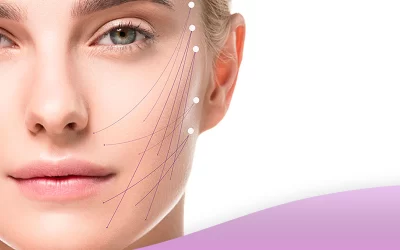 کانتورینگ صورت با اندولیفت، مزایا، روش انجام و مراقبت های لازم